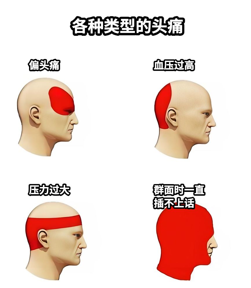 各种类型的头痛偏头痛血压过高压力过大群面时一直插不上话