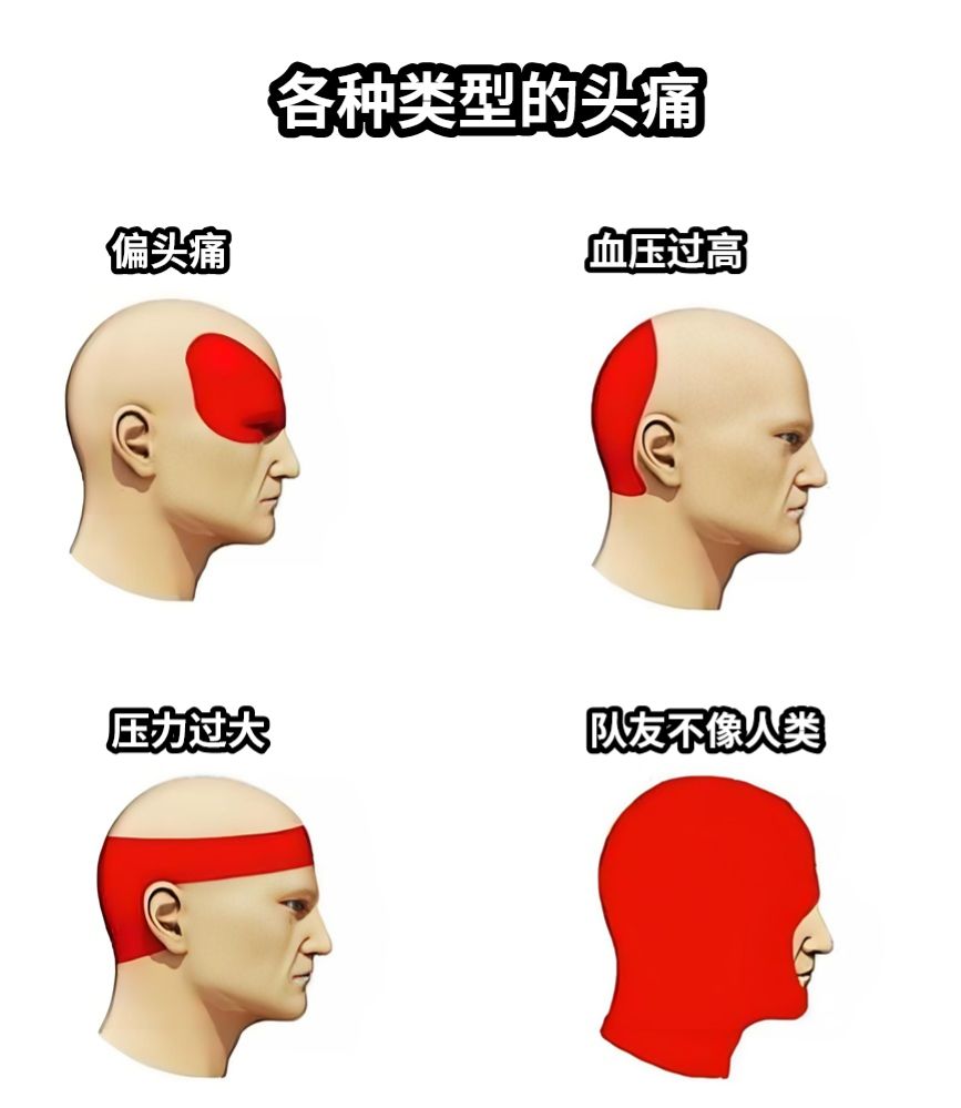打游戏时的头疼